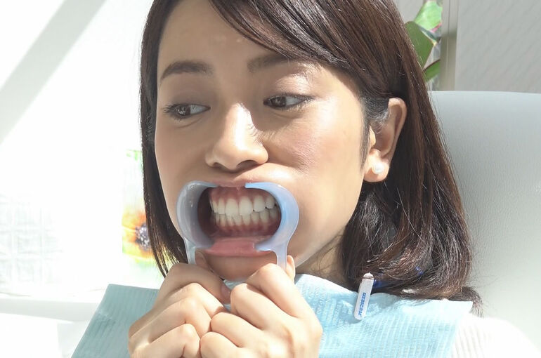 ホワイトニング