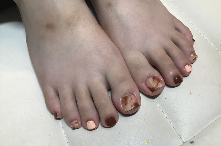 ネイル